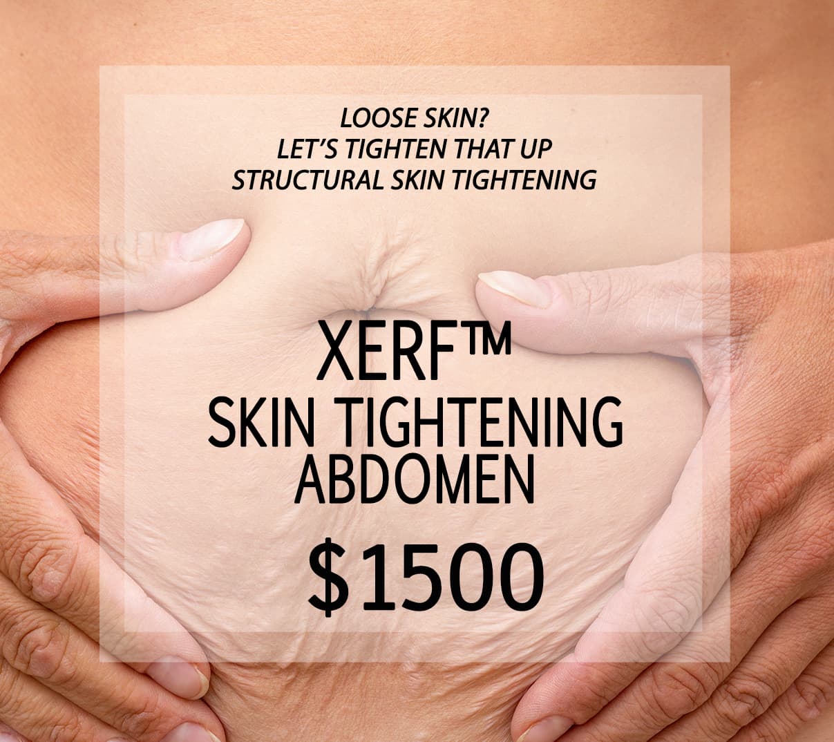 Xerf Skin Tightening Abdomen
