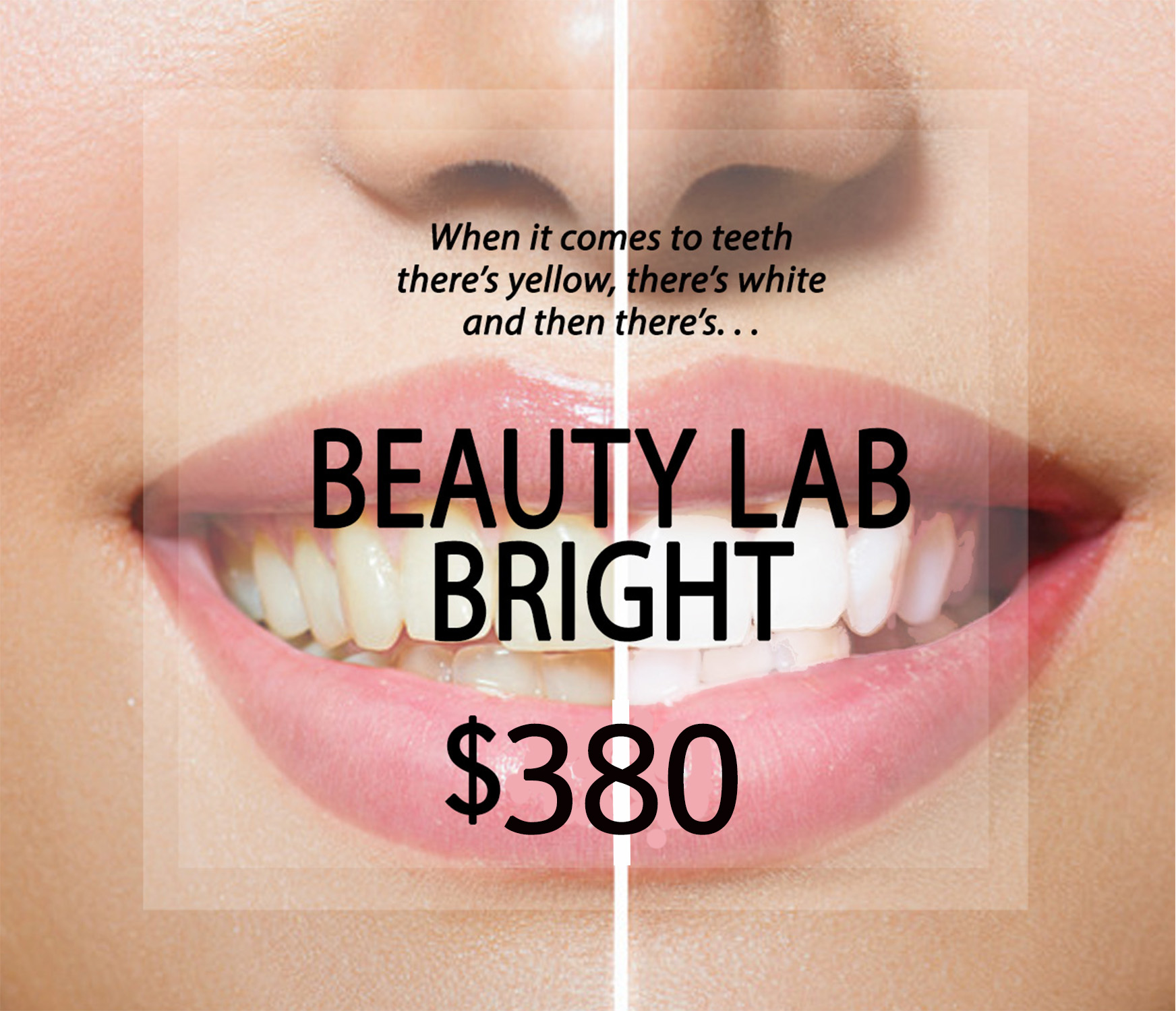 Beauty Lab Bright Teeth Whitening Full Treatment