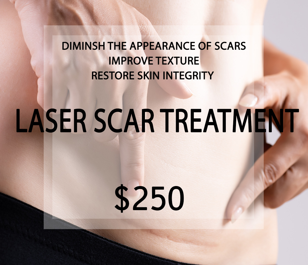 Laser Scar Treatment