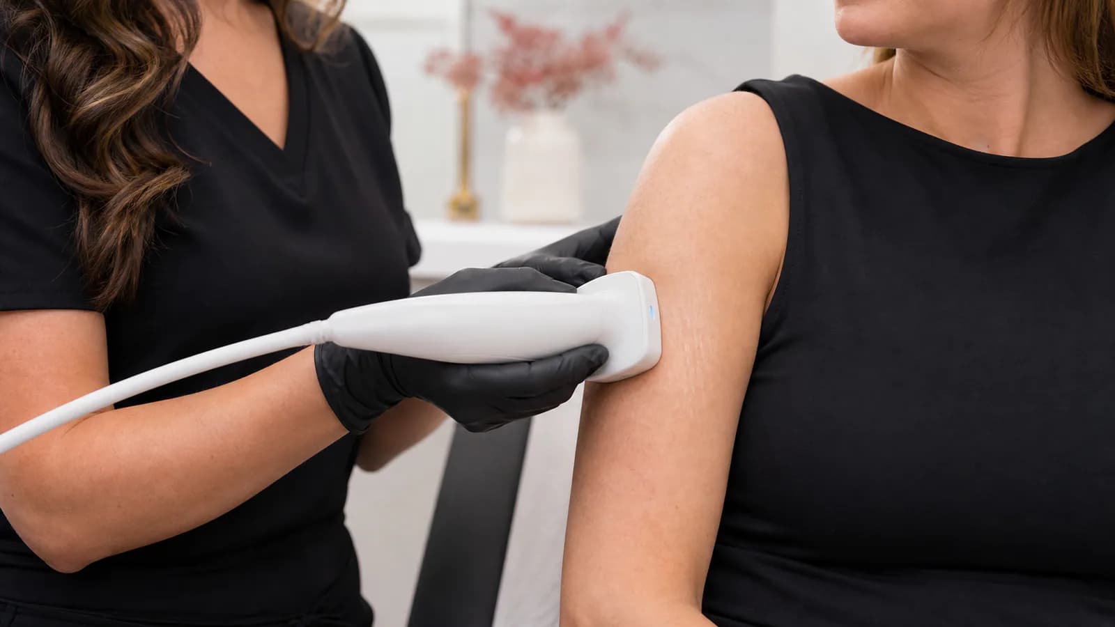 Medical aesthetics provider performing radiofrequency treatment on upper-arm stretch marks.